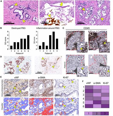 Evidence for Recipient-Derived Cells in Peribiliary Glands and Biliary Epithelium of the Large Donor Bile Ducts After Liver Transplantation